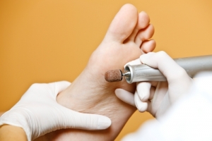 Corns and calluses treatment